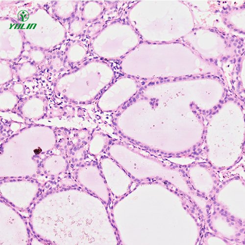 人內(nèi)分泌系統(tǒng)疾病標(biāo)本片