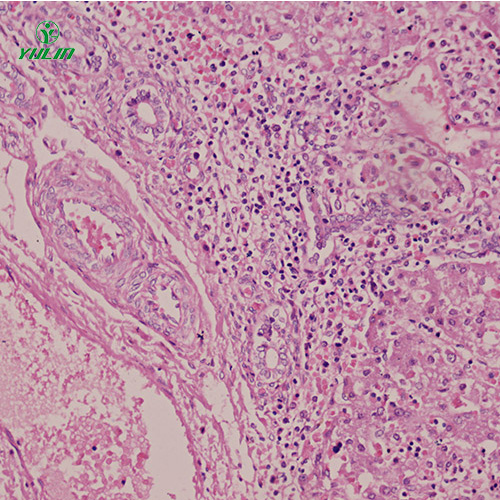 人消化系統(tǒng)疾病標(biāo)本片