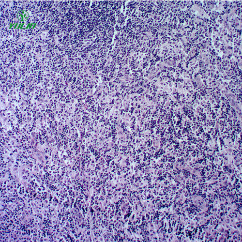 人體免疫性疾病切片